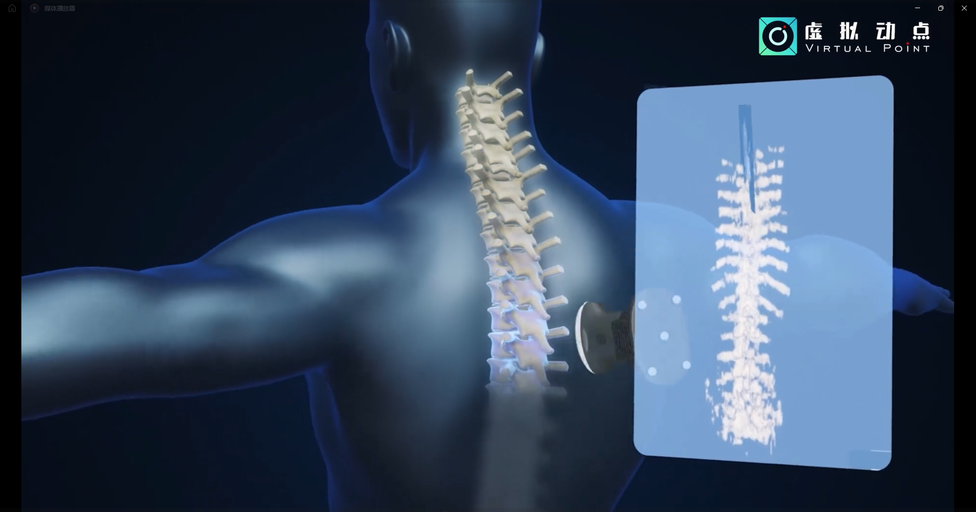 【爱体育】官网·虚拟动点OptiTrack开创3D超声成像在脊柱诊断中的应用